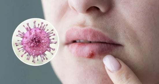 Read more about the article ما هي الأعراض والأسباب الأكثر شيوعًا لمتلازمة حساسية الفم؟