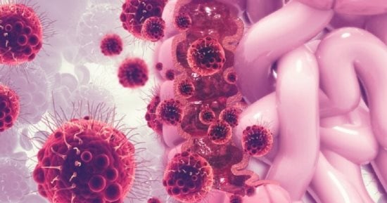 Read more about the article كيف تعرف أعراض سرطان الأمعاء؟  طريقة العلاج
